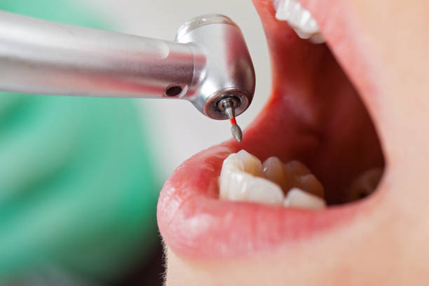 Best Emergency Treatment for Toothache in Stryker, OH